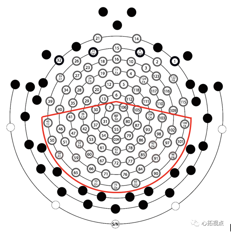 北师大研究团队利用高密度脑电技术在《Human Brain Mapping》发文揭示ADHD儿童的视觉目标定向受损机制