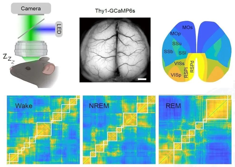 徐敏组发现枕叶皮层对快速眼动睡眠的调控作用